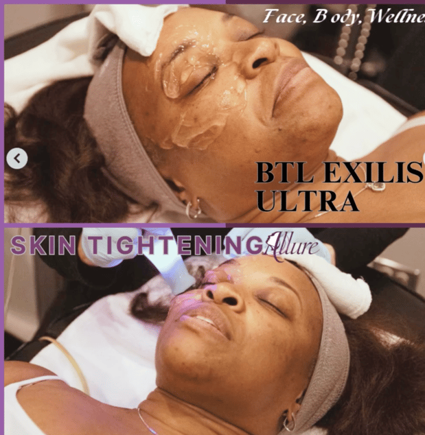Images Allure Laser & Med Spa