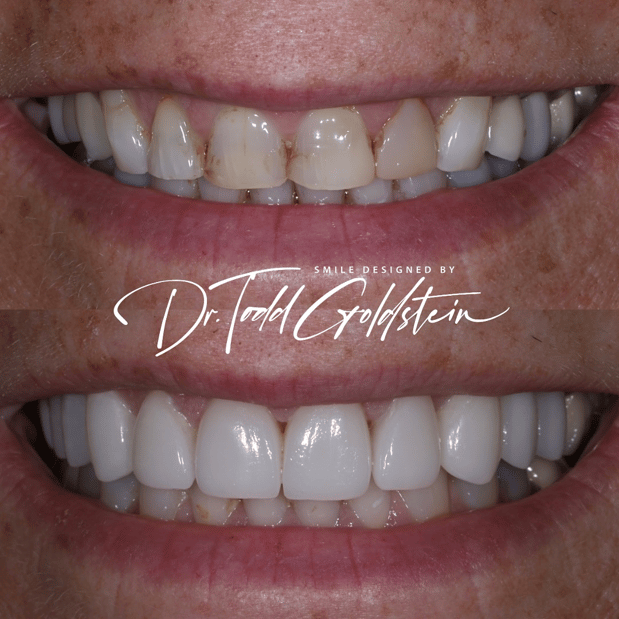 Images The Smile Aesthetic