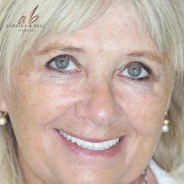 Images Almeida & Bell Dental Lone Tree - General, Cosmetic, and Implant Dentistry