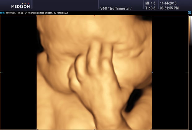 Images Heavenly 3D 4D Ultrasounds