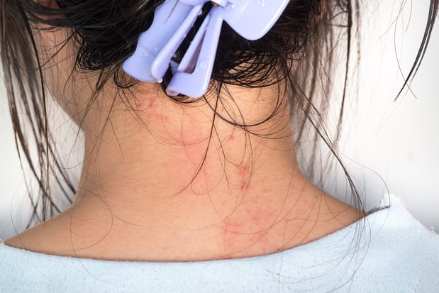 Images Gupta Allergy: Allergy & Asthma Specialists of Lansing, PLLC