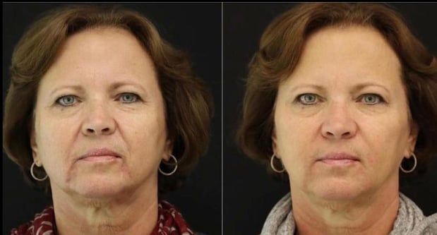 Images 740 Park Plastic Surgery: Stafford R. Broumand, MD, FACS