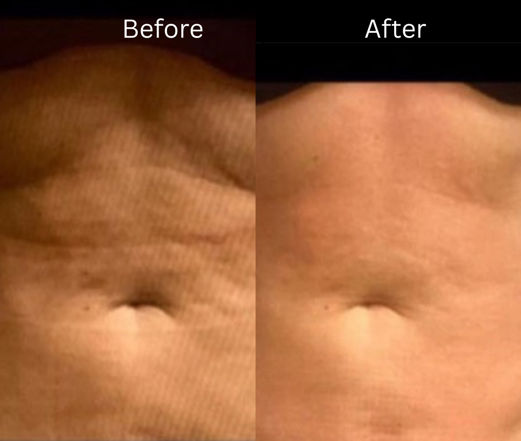 Images Onyx Esthétique - Soins esthétiques, Soins de la peau, Laser Cynosure Gatineau
