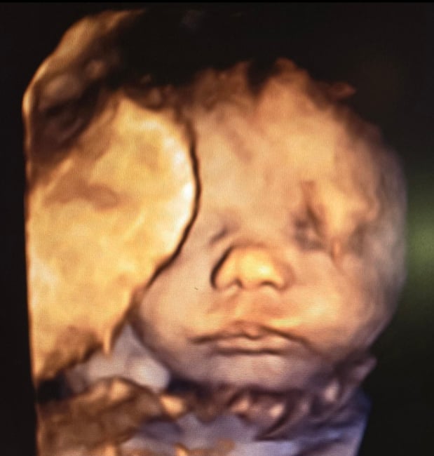Images Love At First Sight 3D/4D Ultrasound Imaging Studio, LLC