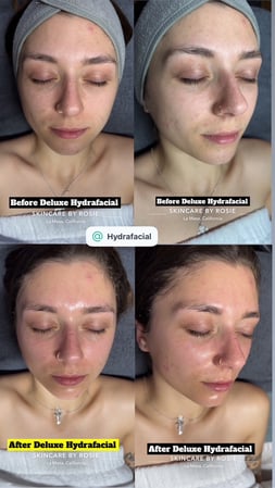 Images Skincare by Rosie