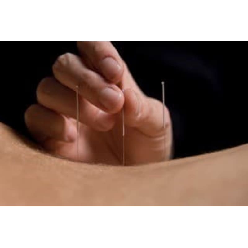 Images Zadi Hasan Barnet Acupuncture