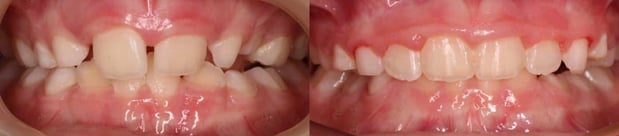 Images TLC Pediatric Dentistry and Orthodontics