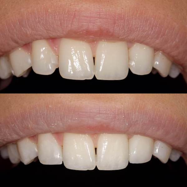 Images Avenue Dental