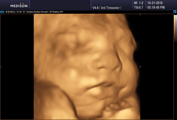 Images Heavenly 3D 4D Ultrasounds