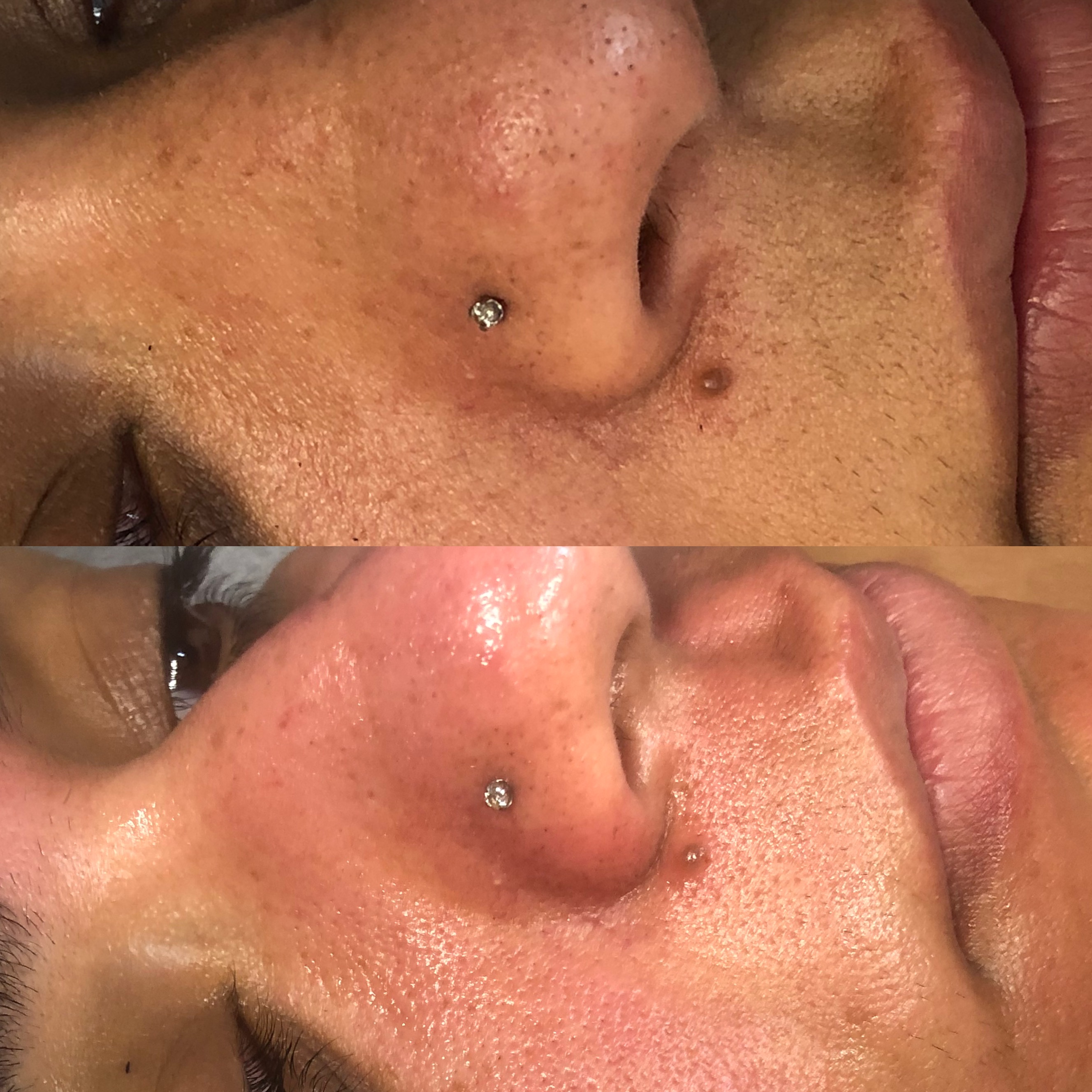 Images Clinique d'Esthétique Leila - Hydrafacial, Microblading, Épilation Laser Sainte-Foy