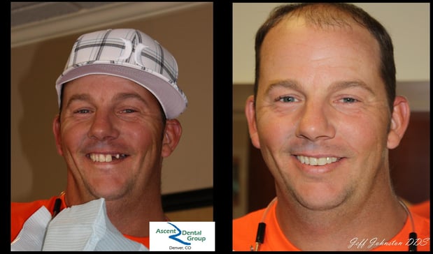 Images Ascent Dental