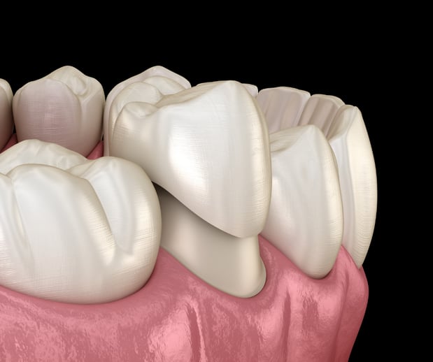 Images Silver State Dental