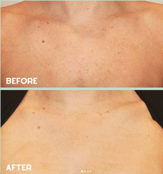 Images MedDerm Dermatology