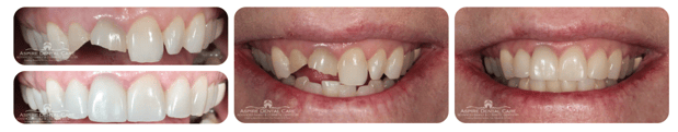 Images Aspire Dental Care PLLC