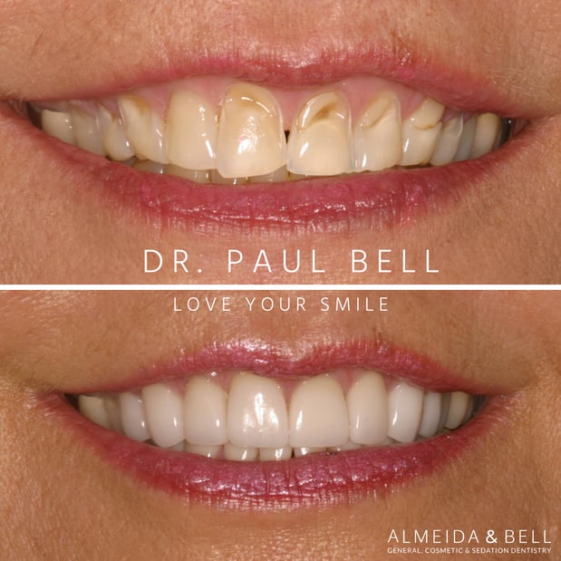 Images Almeida & Bell Dental Lone Tree - General, Cosmetic, and Implant Dentistry