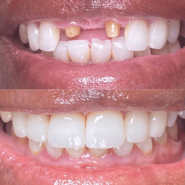 Images Selfie Smiles Dental Group