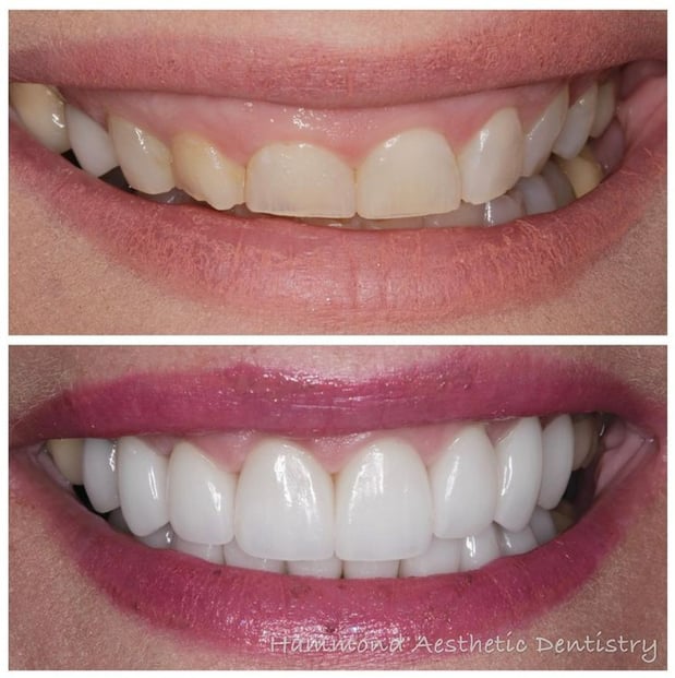 Images Hammond Aesthetic & General Dentistry
