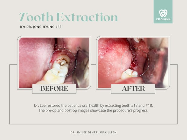 Images Dr Smilee Dental of Killeen, Family, Cosmetic, Implant, Medspa