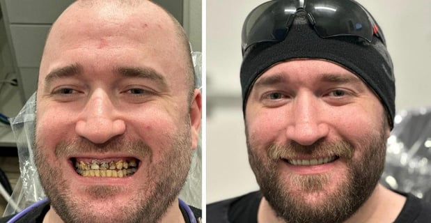 Images Redeemed Smiles - Dentures Implants & Dentistry Yukon
