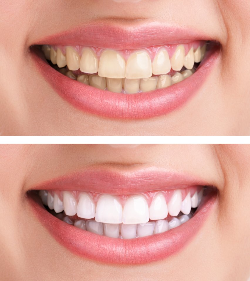 Images Clinique Dentaire Dr. Karam - Dentiste, Blanchiment Dentaire Ahuntsic
