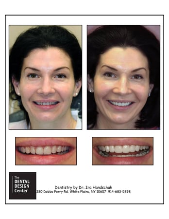 Images The Dental Design Center - Cosmetic, Implant & General Dentistry