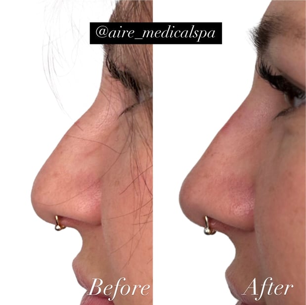 Images Aire Medical Spa