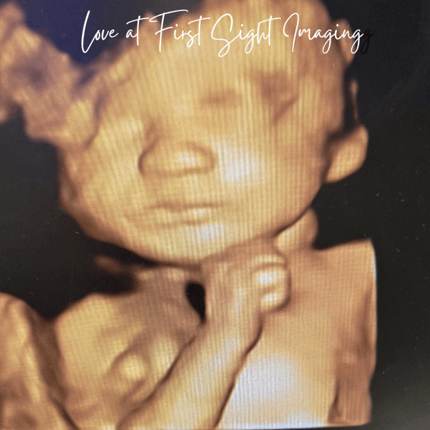 Images Love At First Sight 3D/4D Ultrasound Imaging Studio, LLC