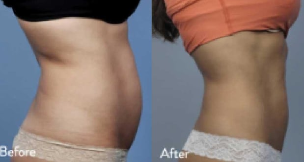 Images EliteBio: Hormone and Aesthetic Solutions