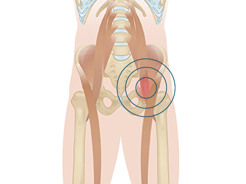 Cncrns_Cndtns-hippain-inner-392x294@2x.jpg