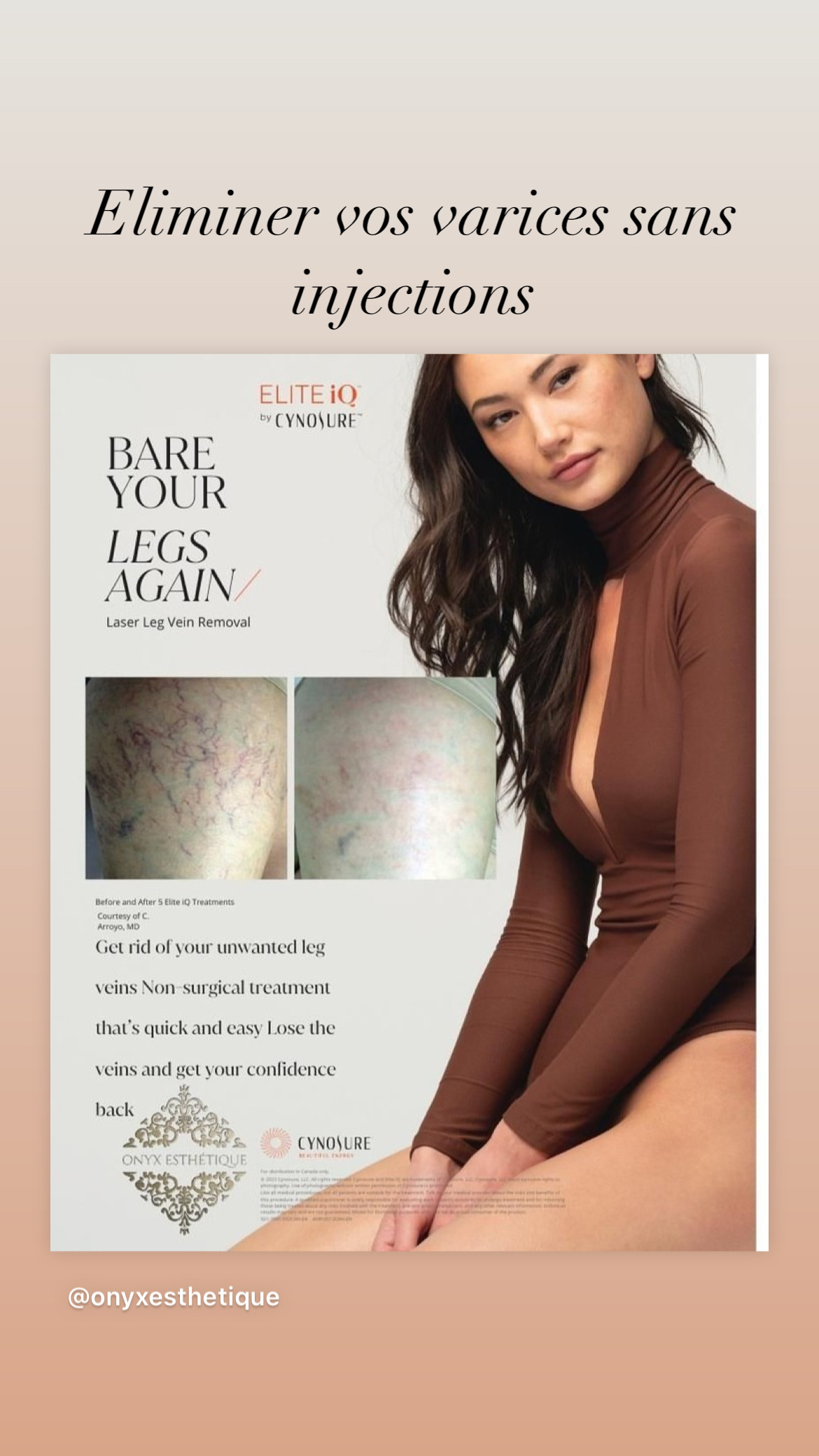 Images Onyx Esthétique - Soins esthétiques, Soins de la peau, Laser Cynosure Gatineau