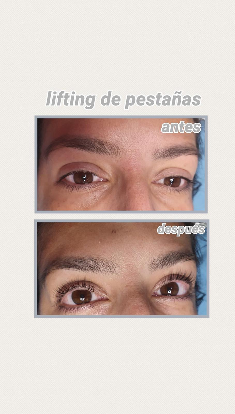 Images Centro De Estética Avanzada Y Láser Verónica Vico