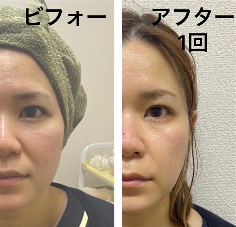 Images 肌質改善サロンサルヴァトーレ長崎