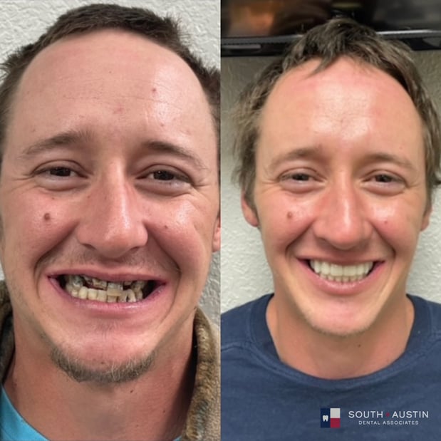Images South Austin Dental Associates
