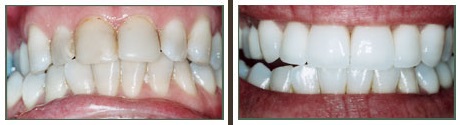 Images Tierrasanta Plaza Dental