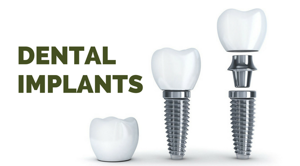 Images Whispering Creek Dental - Dentist Sioux City