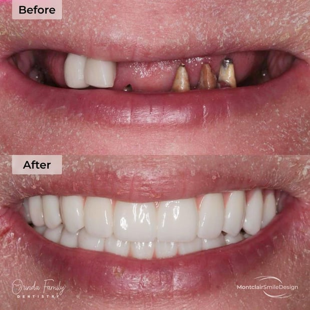 Images Orinda Family Dentistry