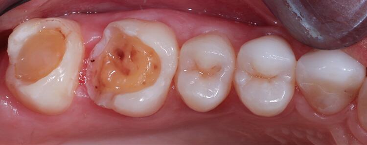 Images Dr. Rodney Raanan