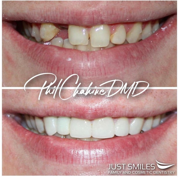 Images Just Smiles - General, Cosmetic & Implant Dentistry