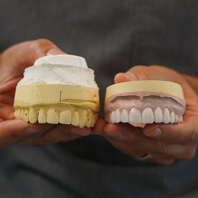 Images Smiles By Eddie: Dr. Edmond Ahdoot DDS