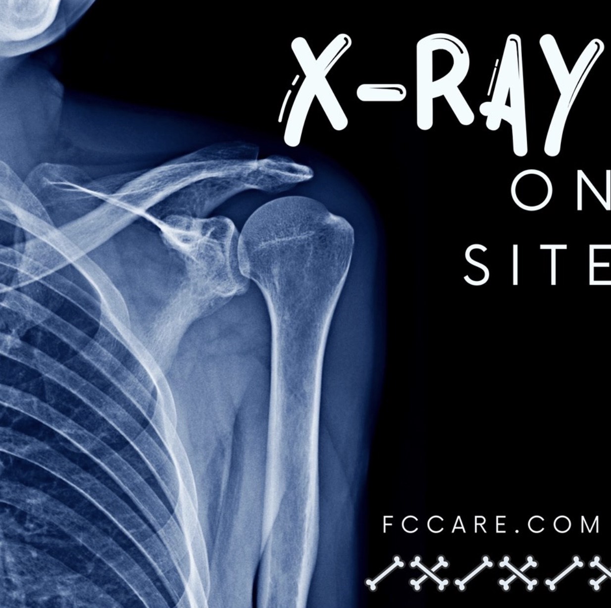 X-Ray On-site