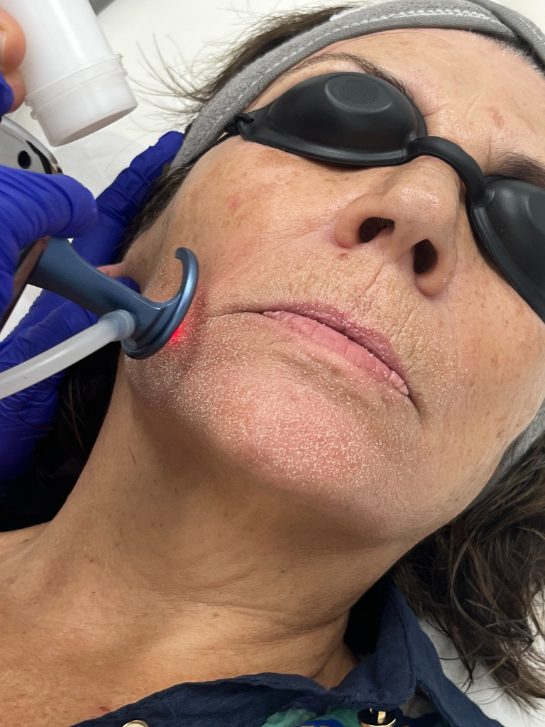 Images Dra. Silvia Solà. Medicina Estética y Láser