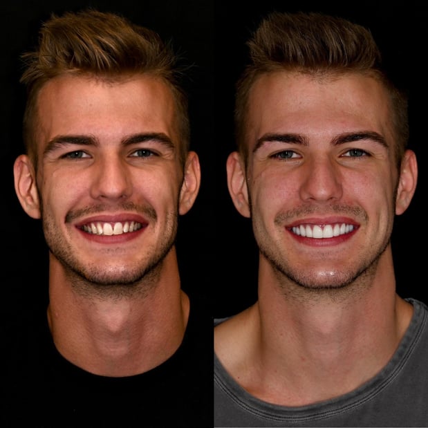 Images Nashville Wisdom Teeth and Implant Solutions