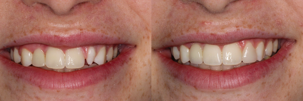 Images Cosmetic and Implant Dentistry of Connecticut