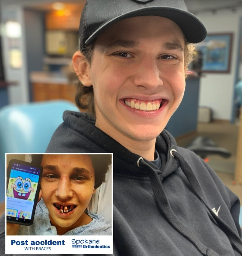 Patient of Karski & Spokane Orthodontics | Seven Fields, PA