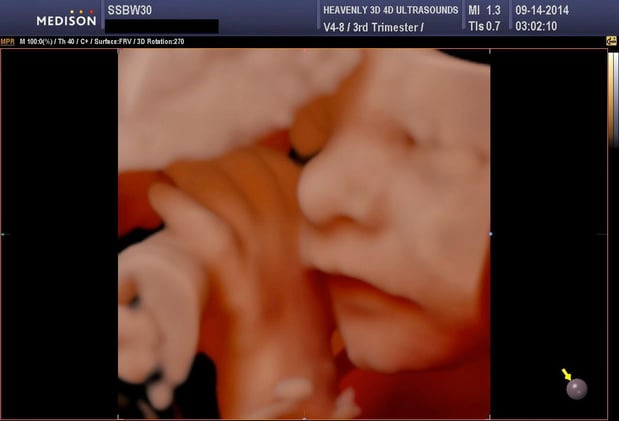 Images Heavenly 3D 4D Ultrasounds-Upland