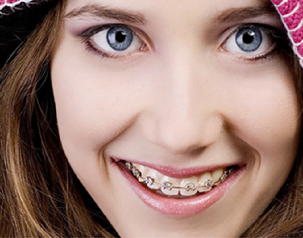 Images Prime Ortodonti AB - Tandreglering Nacka