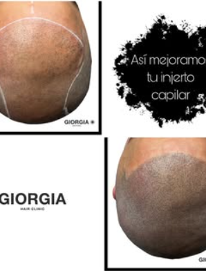 Images Giorgia Hair Clinic