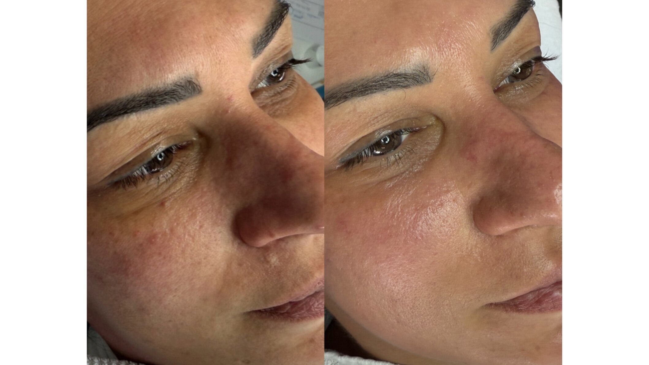SKINNOVA Face & Body, Hauptstraße 2-4 in Herborn