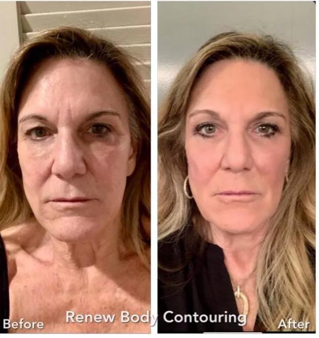 Images Renew Body Contouring & MedSpa