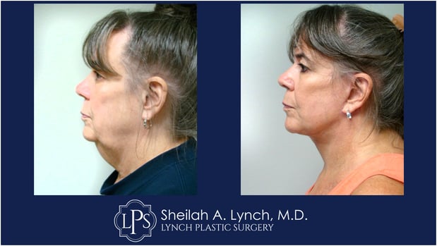 Images Dr. Sheilah A. Lynch